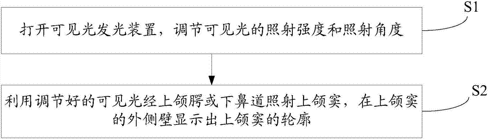 一種用于輔助確定上頜竇外側(cè)壁輪廓的可見(jiàn)光發(fā)光裝置的制造方法