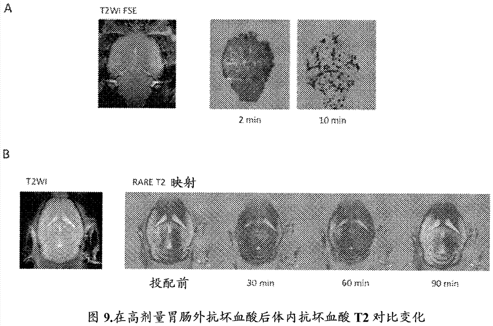 用于磁共振成像的造影劑的制造方法與工藝