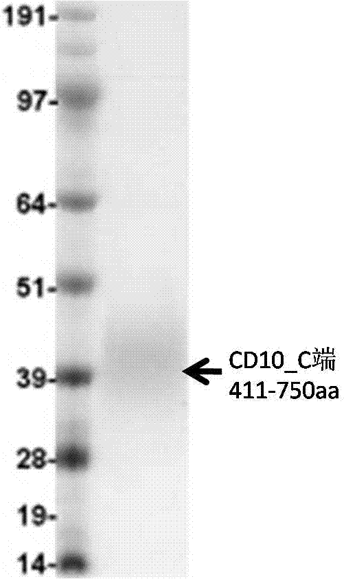 抗CD10蛋白單克隆抗體及其用途的制造方法與工藝