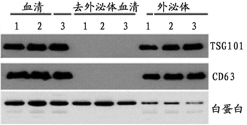 一組核苷酸序列及在EML4?ALK融合基因快速檢測中的應用的制造方法與工藝