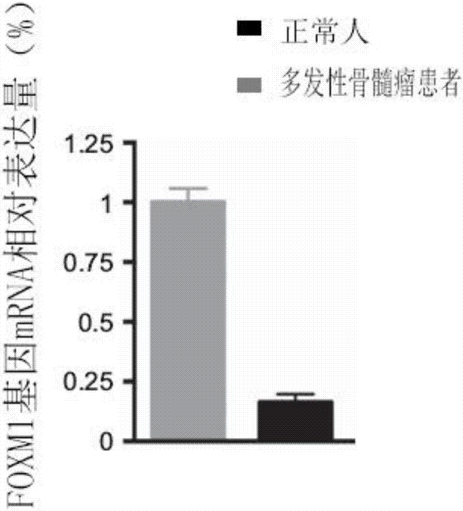 分子標(biāo)志物FOXM1基因的應(yīng)用的制造方法與工藝