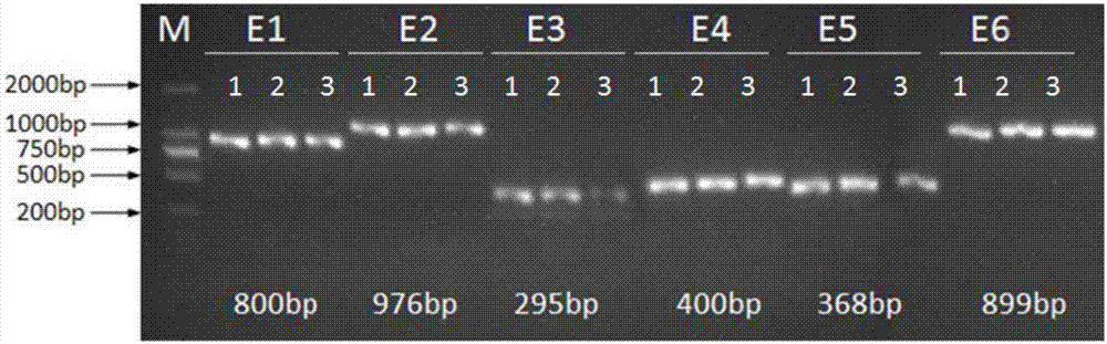 一种检测尼曼‑匹克病SMPD1基因突变的试剂盒和方法与流程