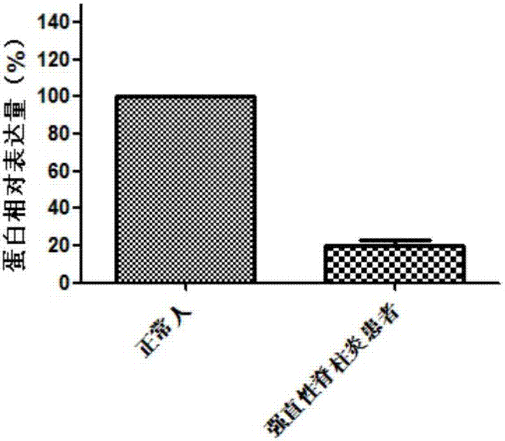 強(qiáng)直性脊柱炎診斷相關(guān)基因的制造方法與工藝