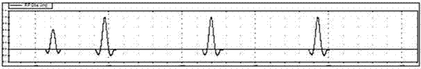 将FSE序列梯度波形转化为三角形的降噪方法及系统与流程
