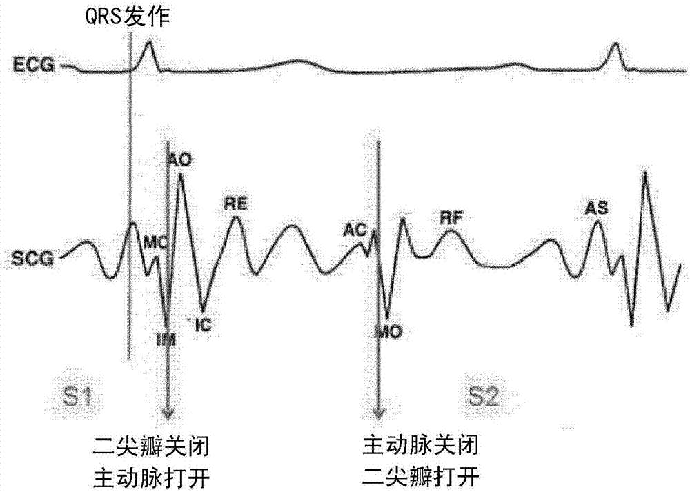 用于处理300模拟量信号的高效程序 (用于处理溢出文本的属性是)