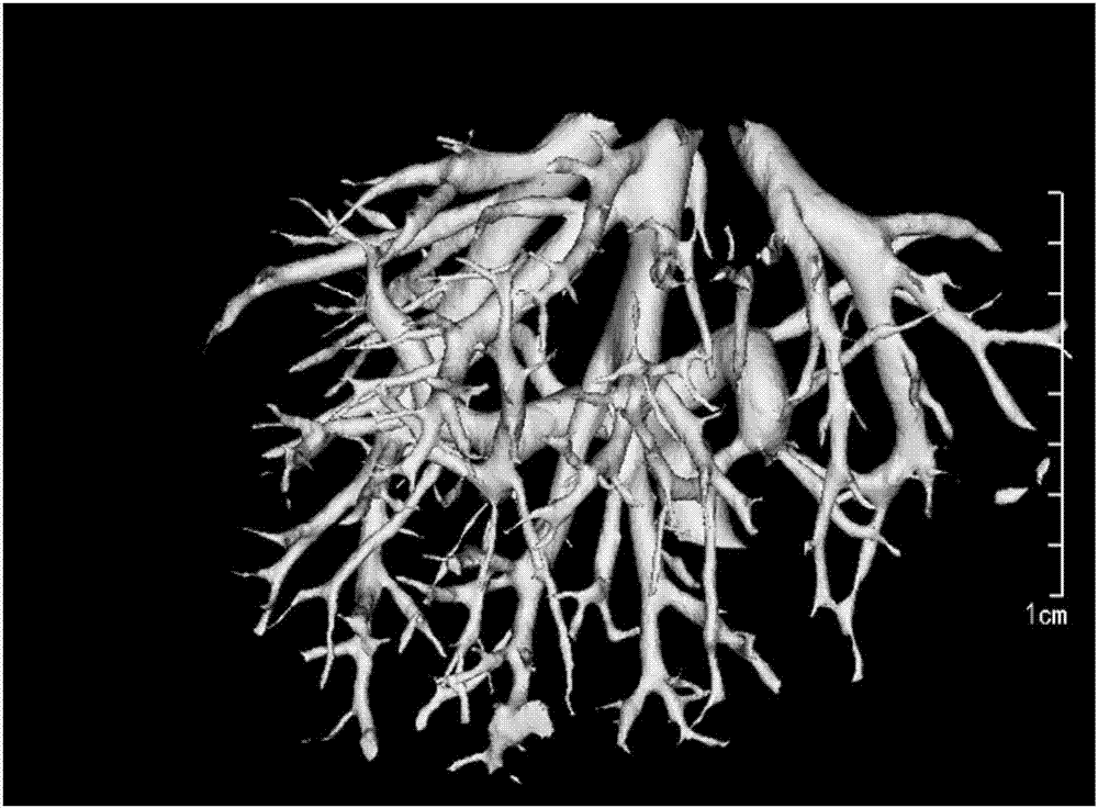 用于三维医学模型中缺失血管的补全方法及装置与流程