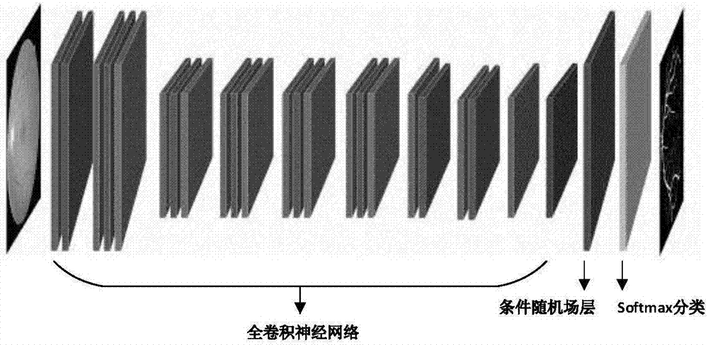 一种基于高效CNN‑CRF网络的视网膜图像分割方法与流程