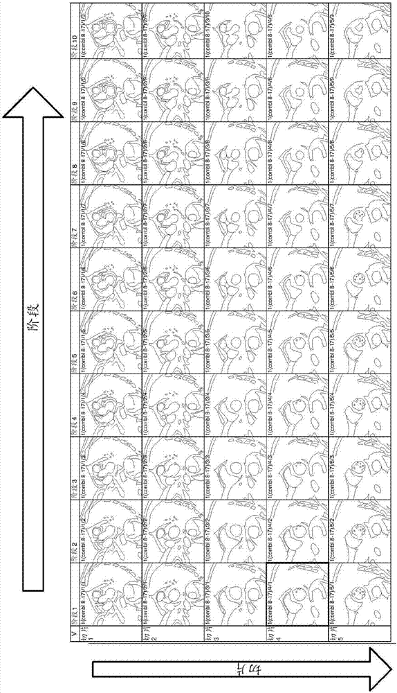 用于心肌壁動(dòng)力學(xué)的分析的方法和系統(tǒng)與流程