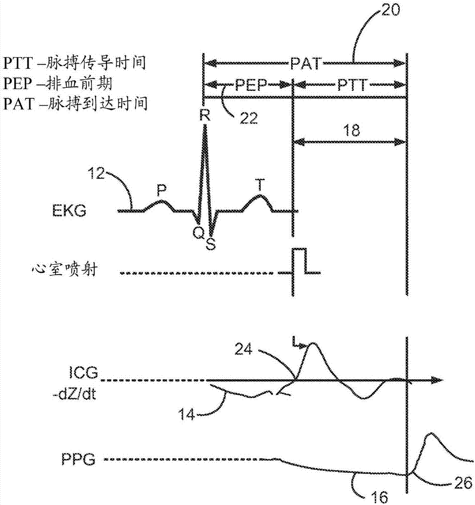 將脈搏傳導(dǎo)時間(PTT)測量系統(tǒng)電耦接到心臟以用于血壓測量的制造方法與工藝