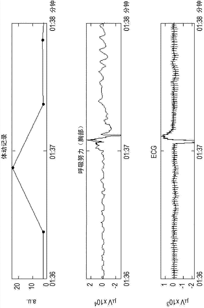 體動記錄方法和裝置與流程