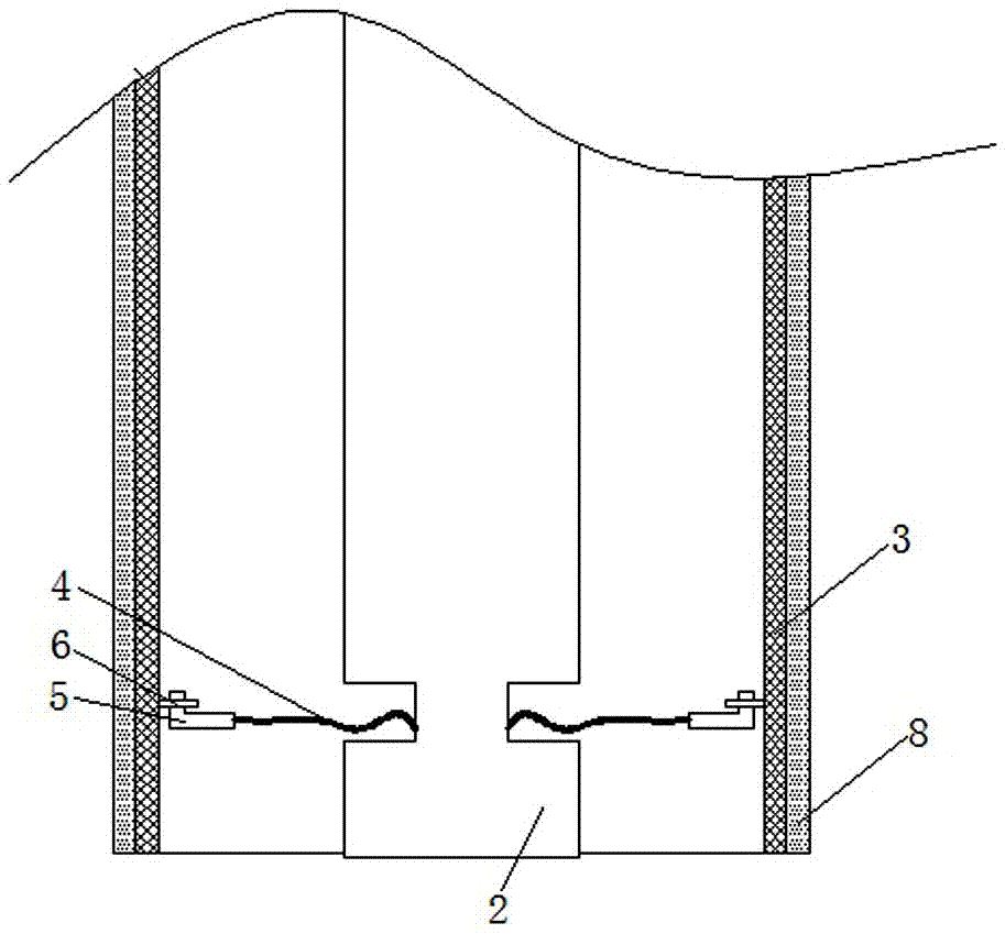 复杂性食道狭窄粒子支架植入装置的制造方法