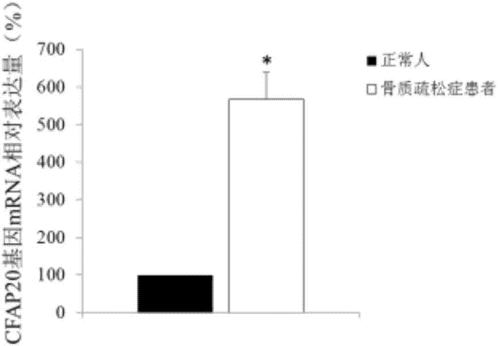 CFAP20基因在骨质疏松症诊断中的应用的制造方法与工艺