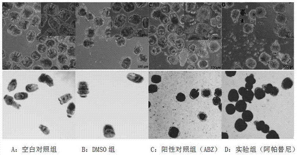 阿帕替尼作為治療包蟲(chóng)病藥物的應(yīng)用的制造方法與工藝