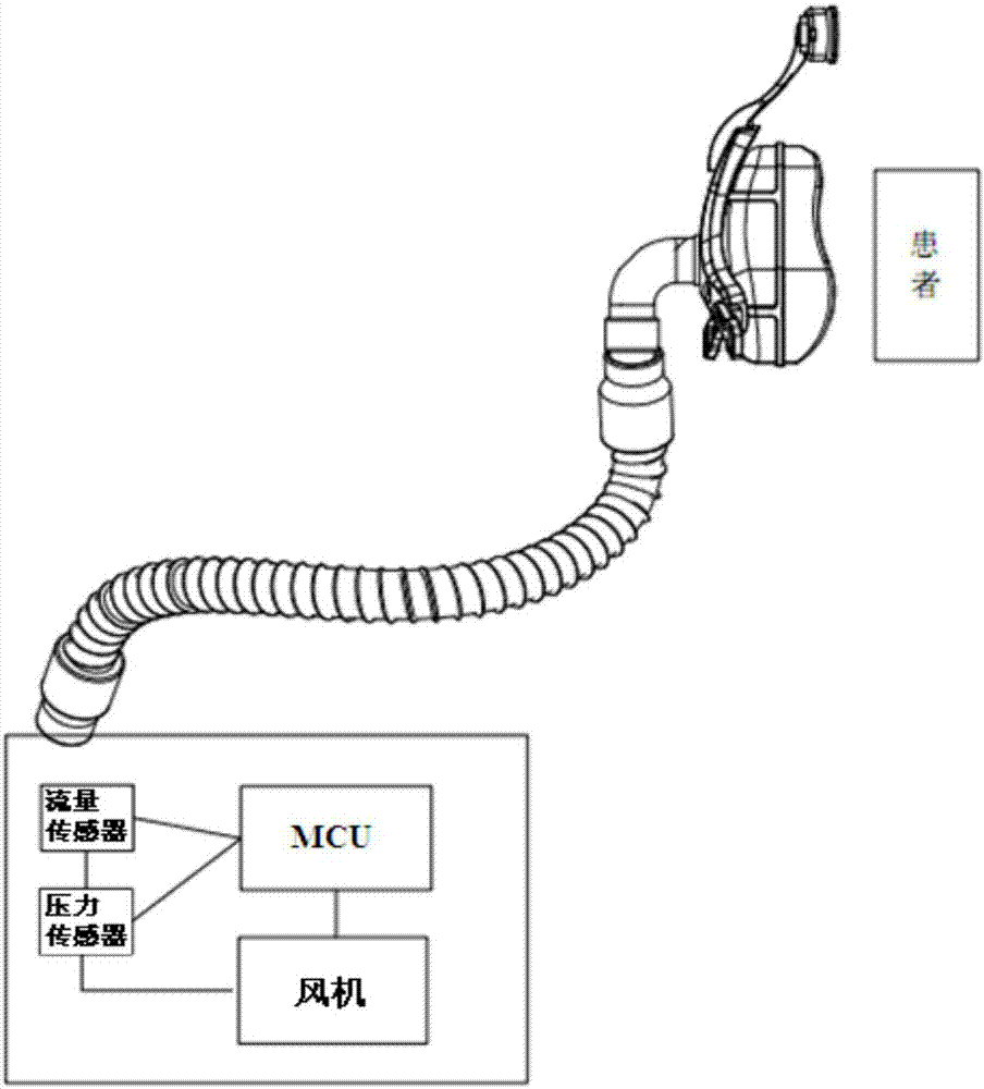 一種用于正壓通氣治療機的呼吸信號判定算法的制造方法與工藝