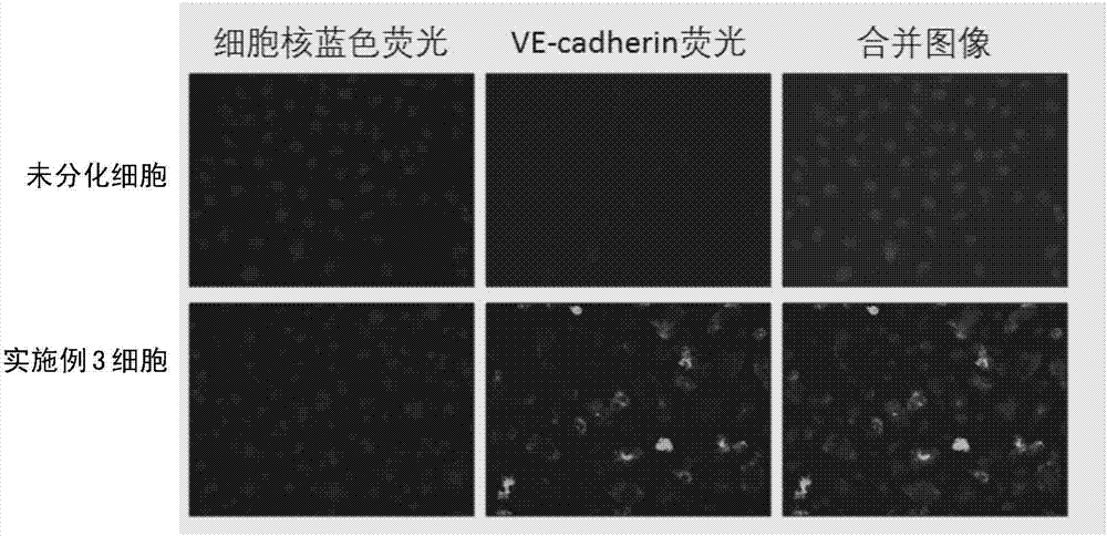 脂肪間充質(zhì)干細(xì)胞向肝星狀細(xì)胞和肝內(nèi)皮細(xì)胞同時(shí)分化的培養(yǎng)基及方法與流程