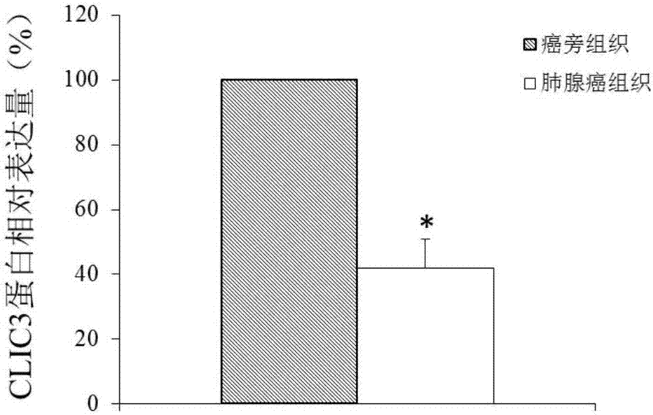 CLIC3作为肺腺癌的诊治靶标的制造方法与工艺