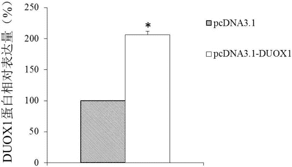 DUOX1作為肺腺癌診治標志物的用途的制造方法與工藝