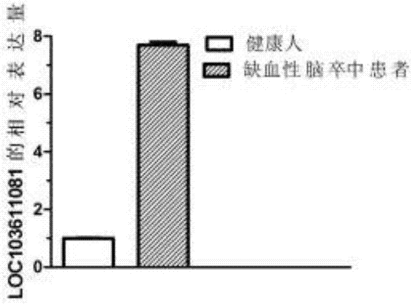 一种与脑卒中发生发展相关的基因的用途的制造方法与工艺