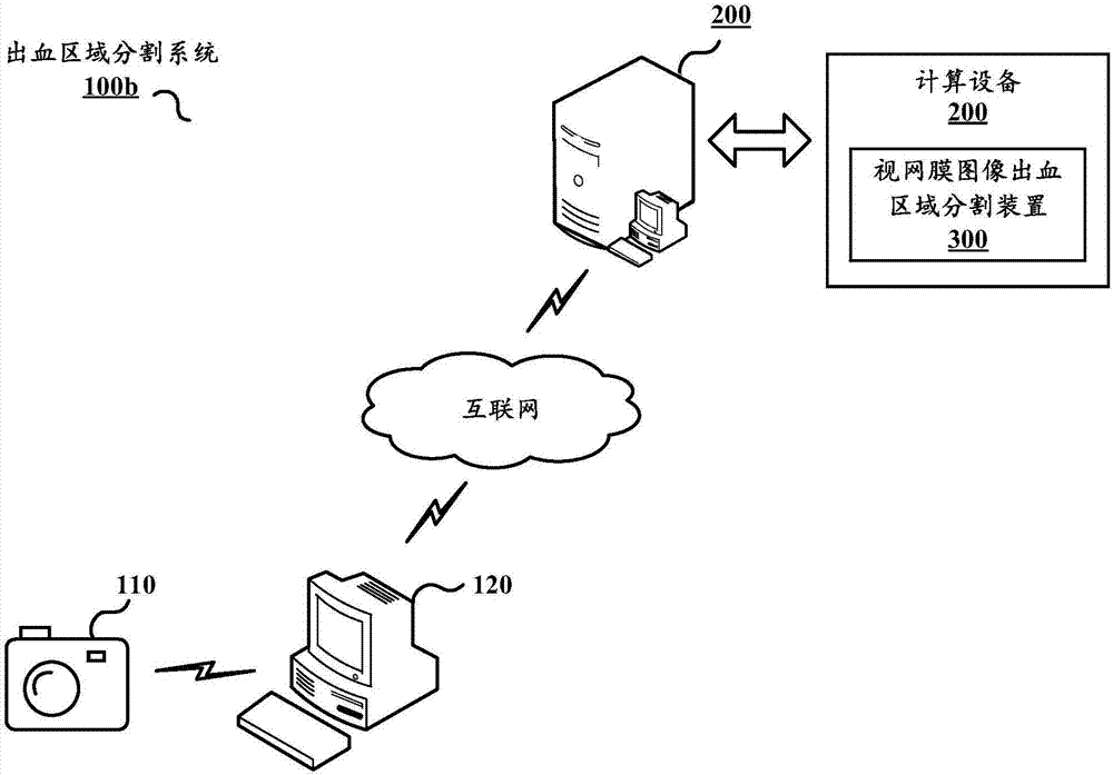 視網(wǎng)膜圖像出血區(qū)域分割方法、裝置和計(jì)算設(shè)備與流程