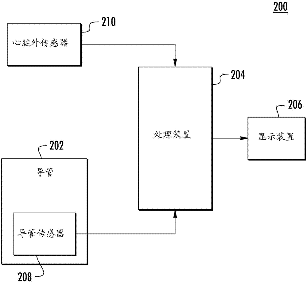 用于確定激活源方向和激活源類型的不重疊環(huán)型或花鍵型導(dǎo)管的制造方法與工藝