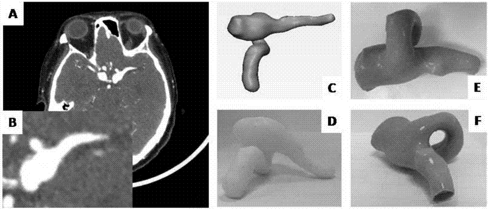動脈瘤血管模型及其制備方法和應(yīng)用與流程