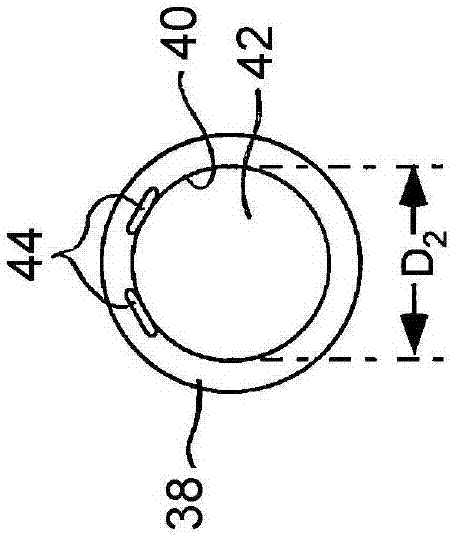 栓塞線圈拆卸機(jī)構(gòu)的制造方法與工藝