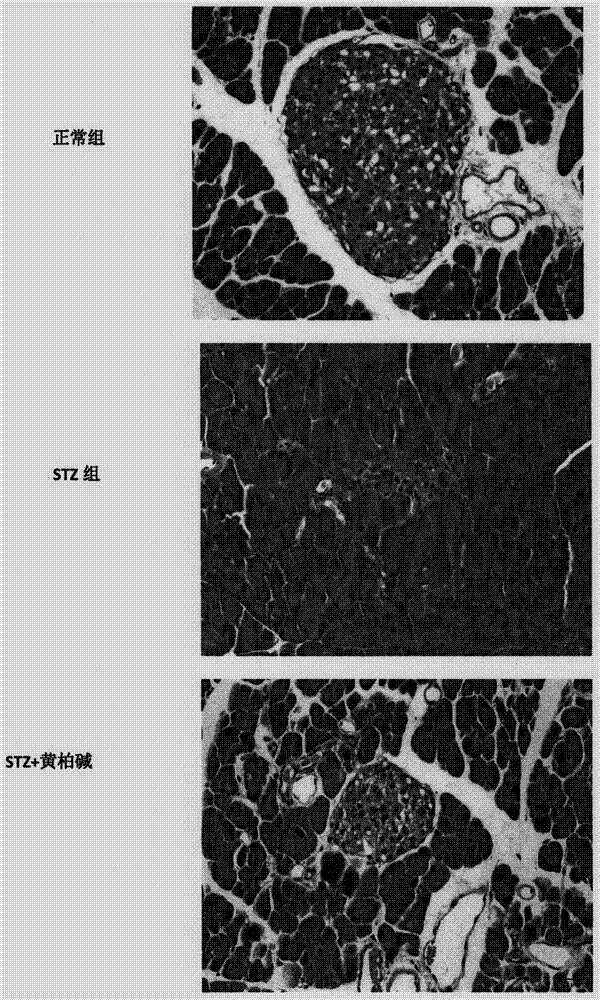 異喹啉生物堿的鹽及晶型的醫(yī)藥用途的制造方法與工藝