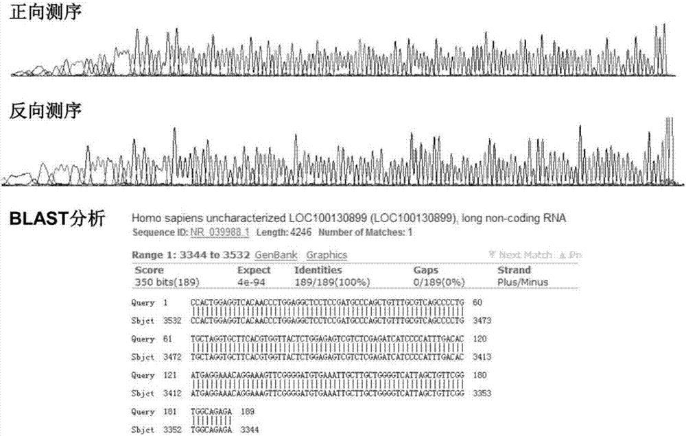 一种检测结直肠癌血清分泌型lncRNAs的引物和试剂盒的制造方法与工艺