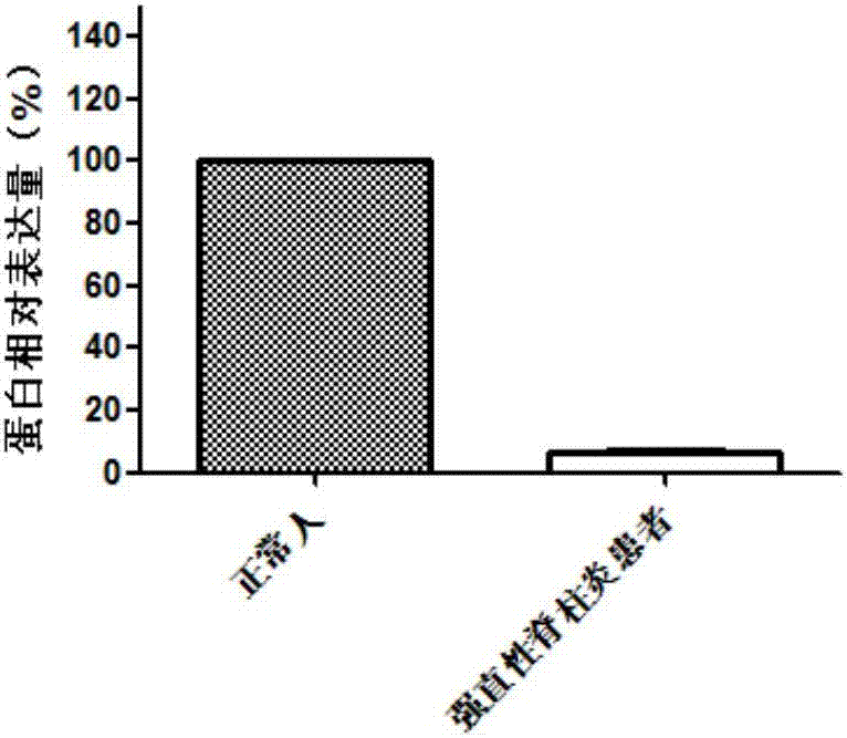 KLHL22基因及其表達(dá)產(chǎn)物在制備診斷產(chǎn)品中的應(yīng)用的制造方法與工藝