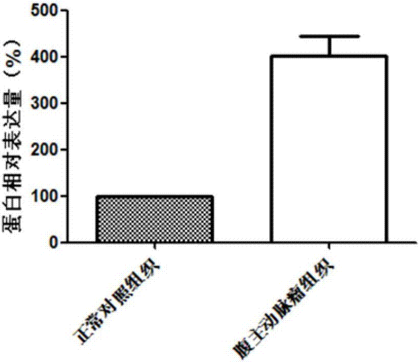 用于診治腹主動脈瘤的生物標志物的制造方法與工藝