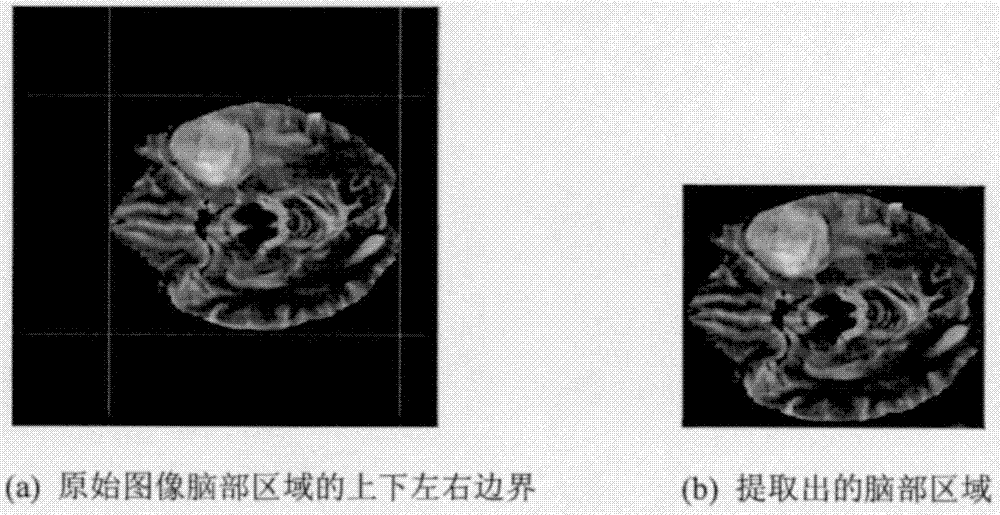 基于全卷积网络的脑部MRI肿瘤分割方法与流程