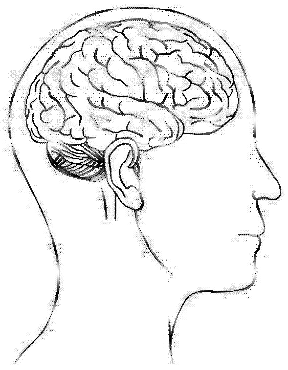 眼镜式脑部活动传感器以及眼镜式电生理活动感测装置的制造方法