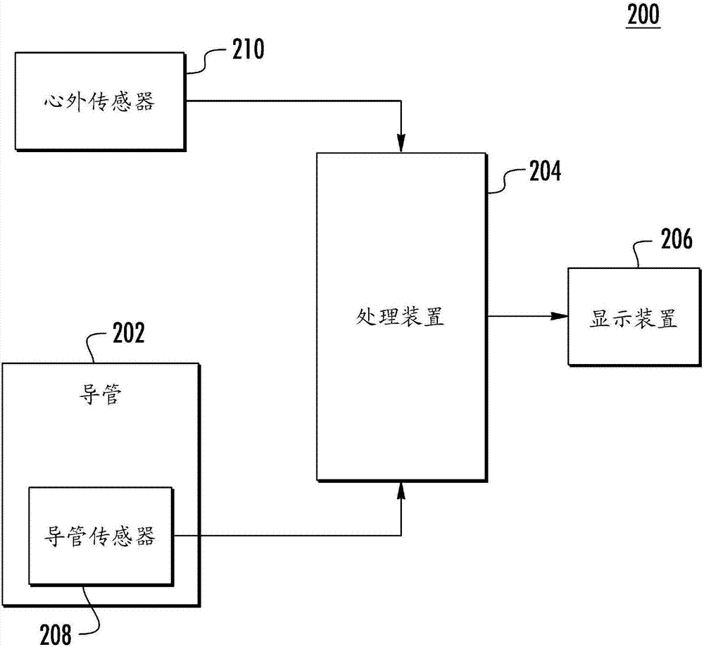 在心房纤颤过程中识别局灶性源的制造方法与工艺