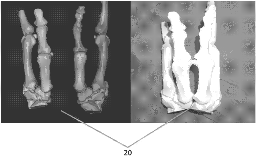 一种手指指骨骨骼增粗塑形骨块模型的制备方法与流程