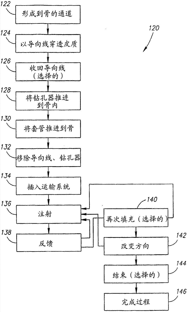 外科用具的制造方法與工藝