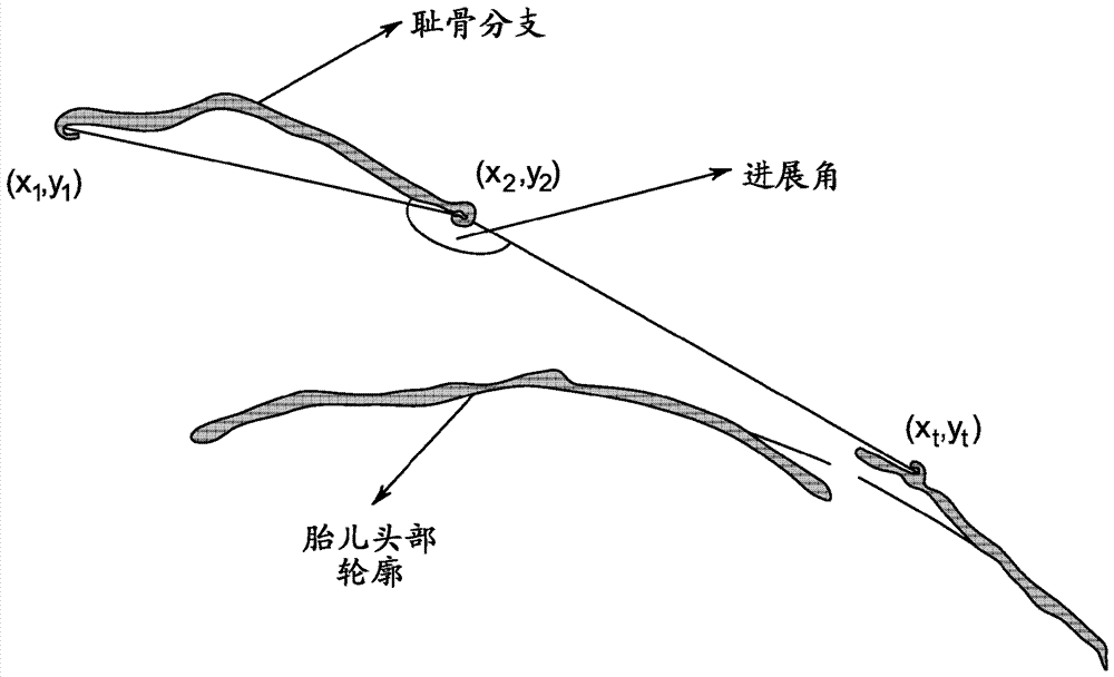 用于通過計算和顯示超聲測量和圖形模型進行胎兒顯像的方法與系統(tǒng)與流程