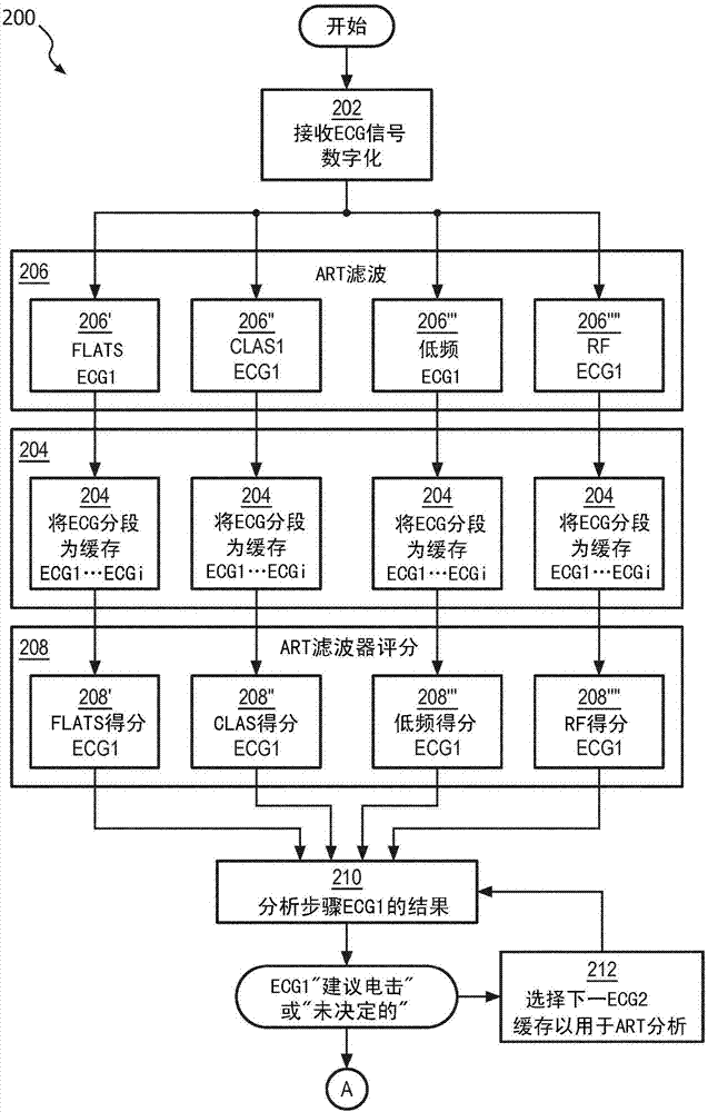 利用雙ECG分析算法來分析用于自動體外除顫器(AED)的選項按鈕的制造方法與工藝