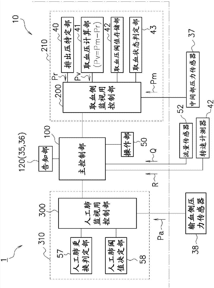 体外循环装置的制作方法