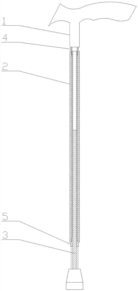 一種伸縮型拐杖的制造方法與工藝