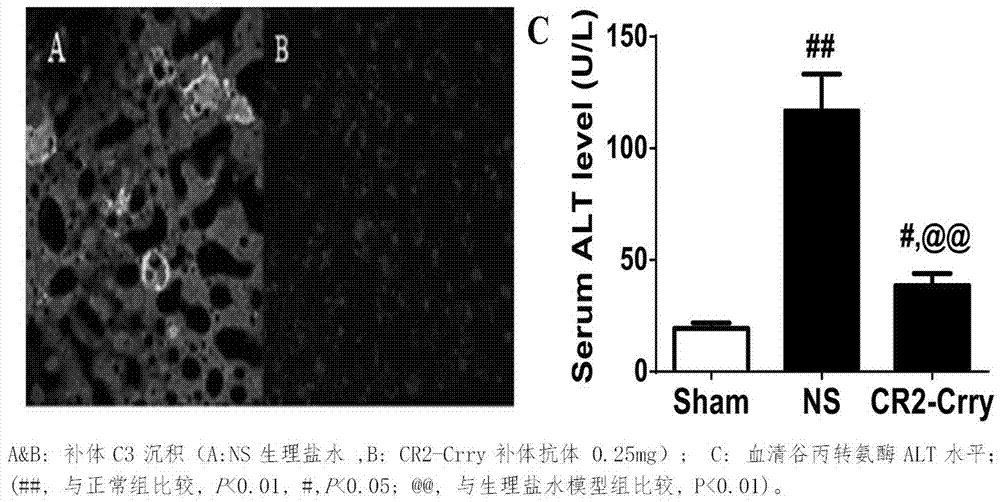 一种治疗酒精性肝病的靶向性补体抗体微囊制剂及其制备方法与应用与流程