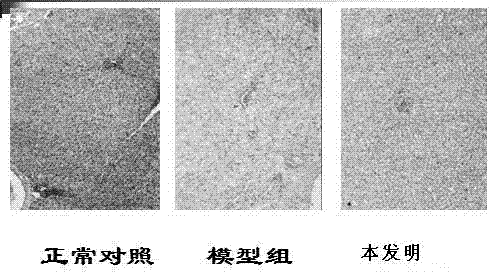 富含載脂蛋白A的人血高密度脂蛋白制劑制造方法及應(yīng)用與流程