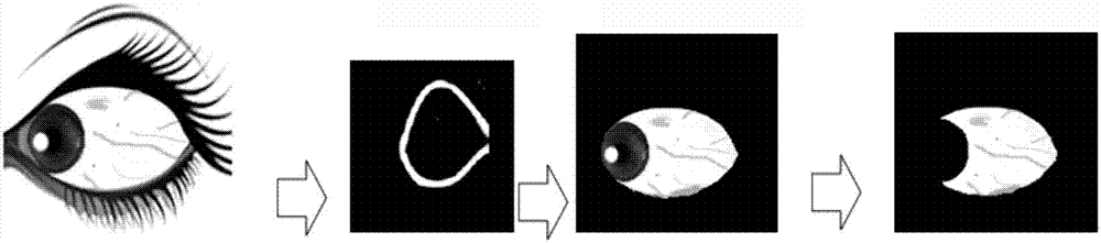 一種真彩色眼象圖白睛區(qū)域的完整提取方法與流程