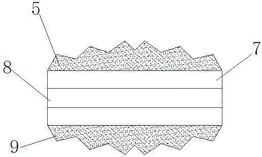 一種穩(wěn)固型椎間融合器的制作方法與工藝