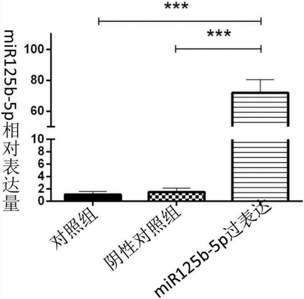 miR125b‑5p在制备抗内皮细胞损伤药物的应用的制作方法与工艺