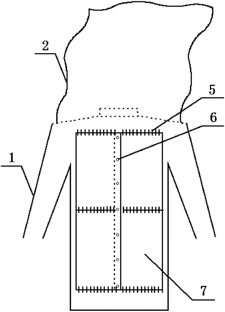 一種背部開口式多功能理療服的制作方法與工藝