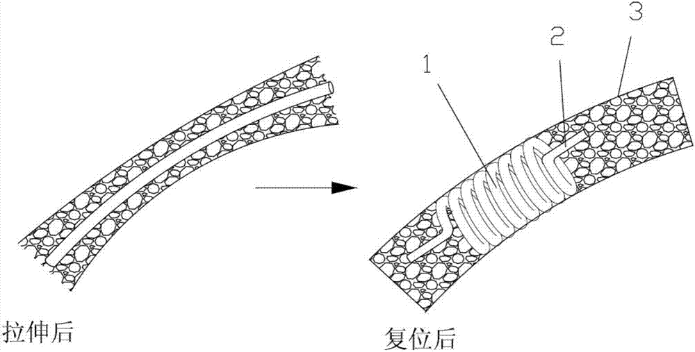 一种可降解管道支架的制作方法