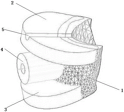 一种辅助儿童肘内翻畸形楔形截骨术的3D打印导航模板的制作方法与工艺