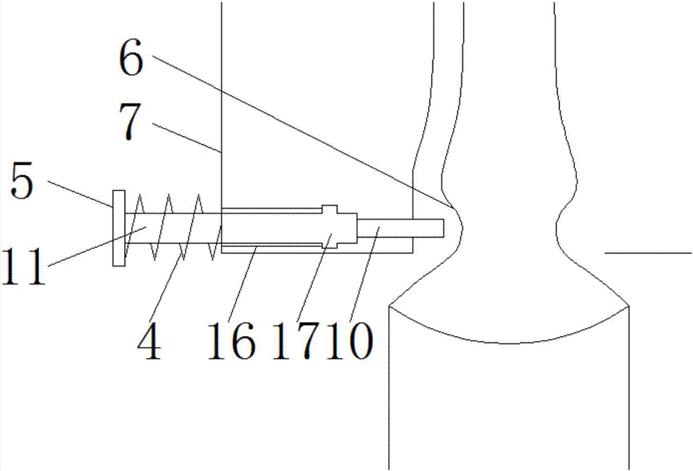 一種急癥科用安瓿瓶開瓶裝置的制作方法