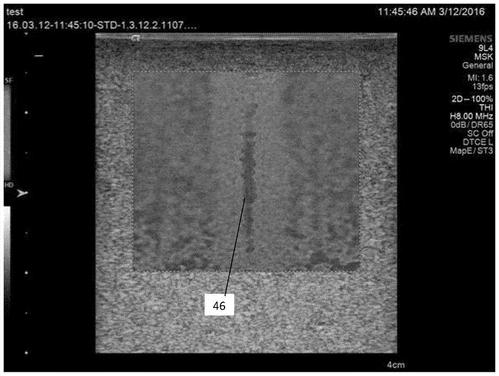 医疗诊断超声成像中的衍射源补偿的制作方法与工艺