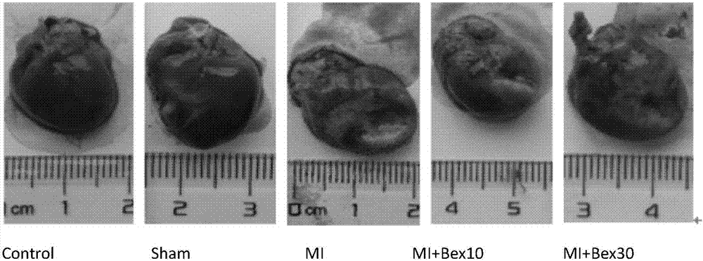 一種調(diào)控TGF?β1?Smads通路的方法及其應(yīng)用與流程